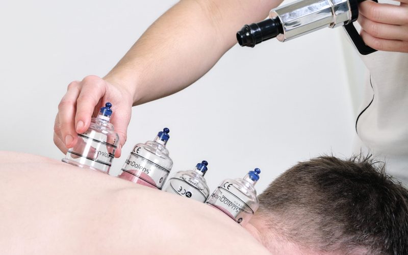 Cupping